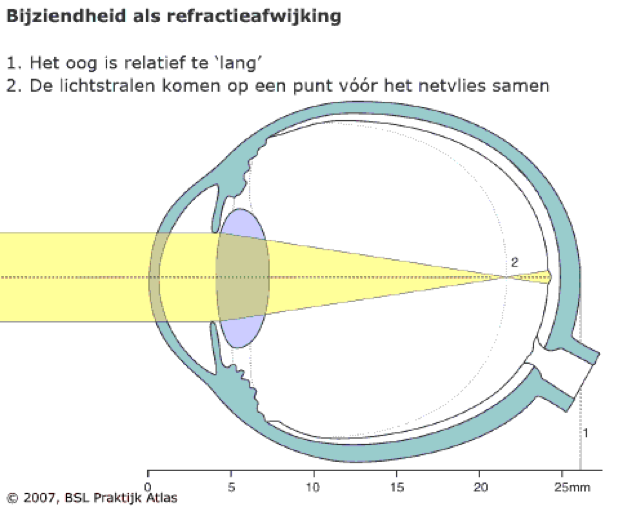bijziendheid
